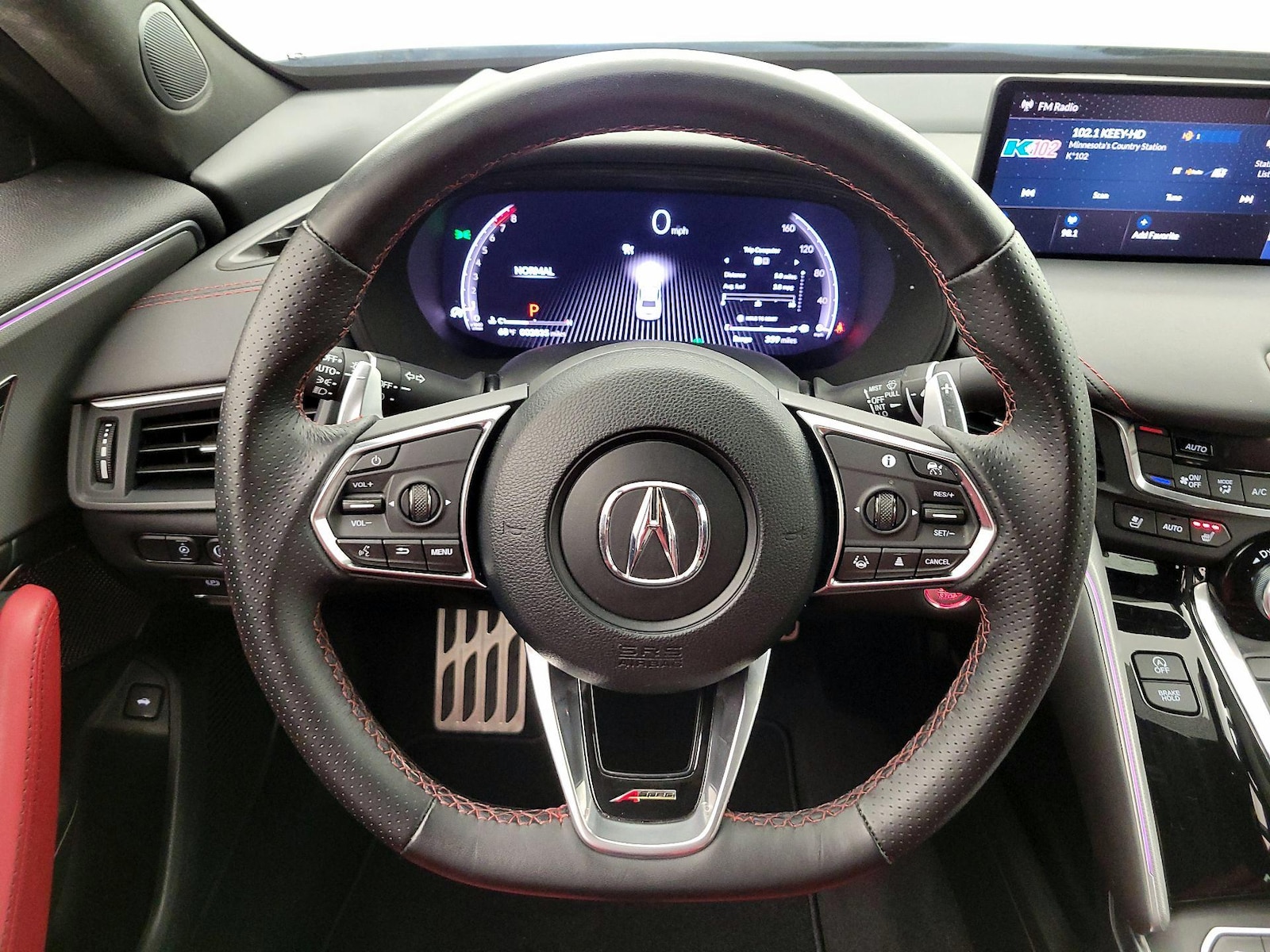 2025 Acura TLX A-SPEC Package - Photo 11