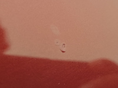 Condition detail