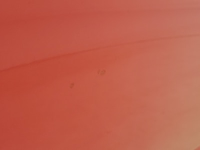 Condition detail
